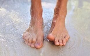 walk barefoot as a cause of fungus