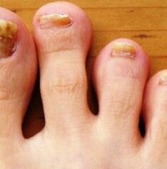 Nog's foot