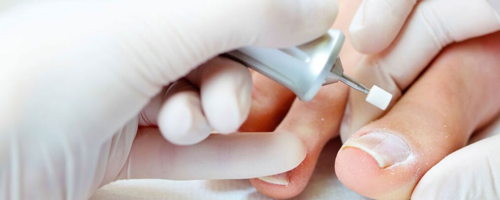 To cut the top layer of the nail