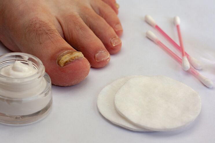 Fingers treating fungi with cream from mushrooms