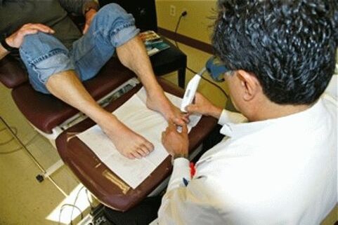 Removal of laser nail fungi