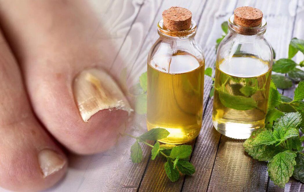 Vinegar for nail fungi