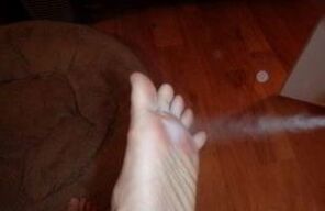 aerosol treatment of the foot affected by the fungus